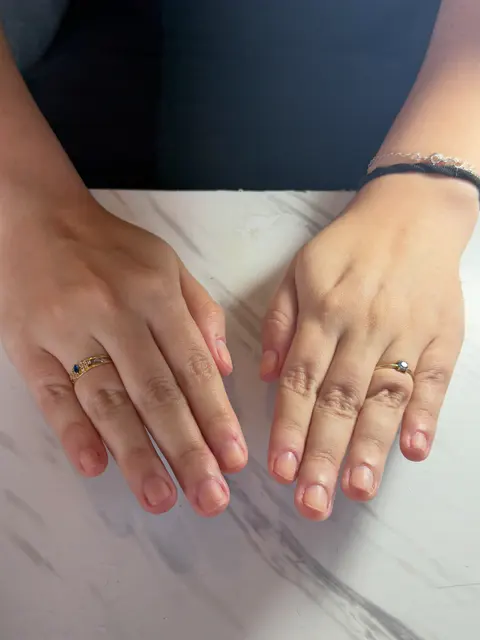 Unhas naturais curtas, antes